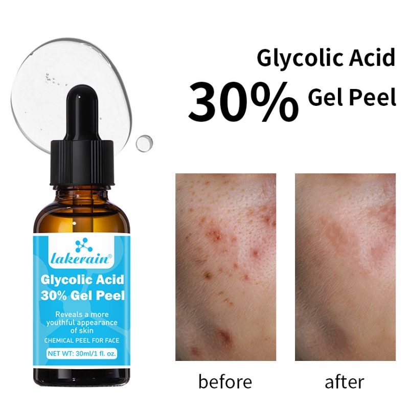 Lactic Acid Toner - 30% Glycolic Acid Peel Gel ProfessionalเกรดเคมีFacial