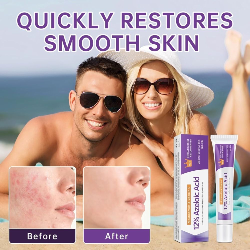 เซรั่มกรดอะซีเลอิก 12% 20% ครี - Azelaic Acid Serum บทวิจารณ์และราคา
