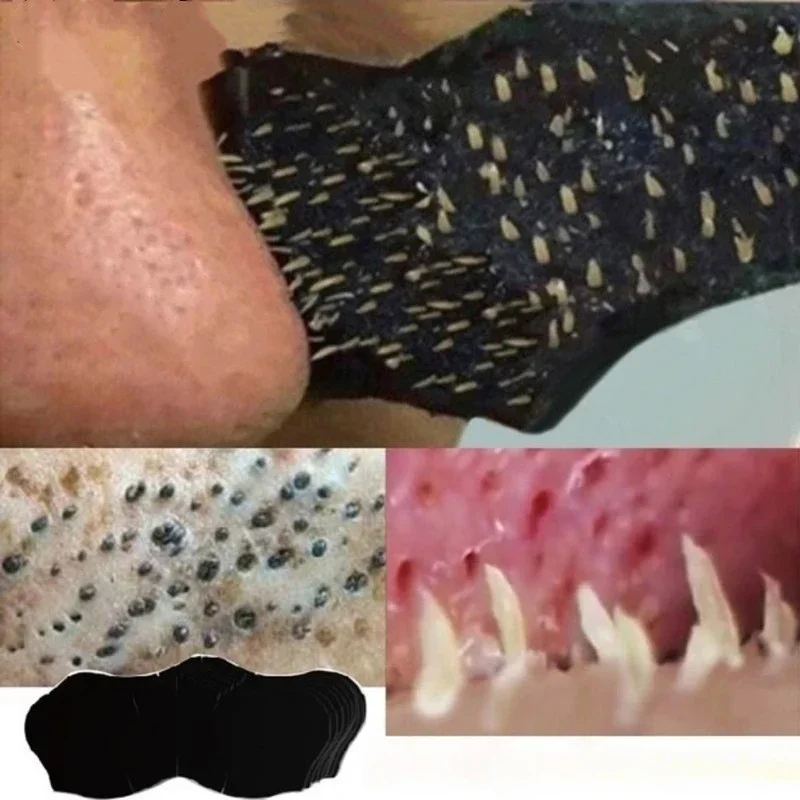 Unisex Blackhead Remove Mask N - Charcoal Pore Strip บทวิจารณ์และราคา
