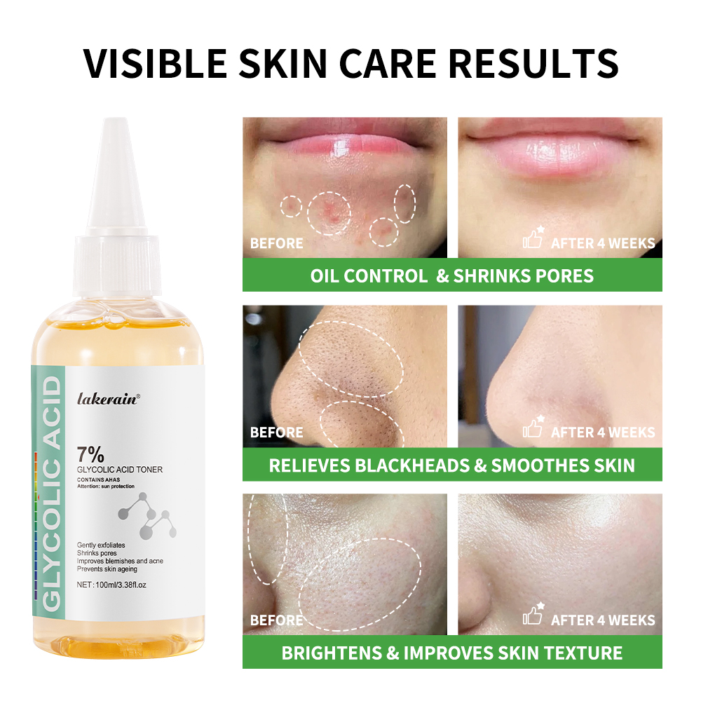 กรดไกลโคลิก7% สารละลายปรับสีผิ - Lactic Acid Toner บทวิจารณ์และราคา