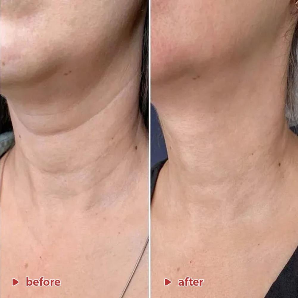 ครีมยกกระชับผิวบริเวณลำคอ 50 ม - Peptide Neck Cream บทวิจารณ์และราคา